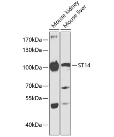 ST14 Rabbit Polyclonal Antibody