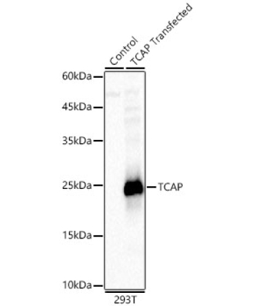 TCAP Rabbit Polyclonal Antibody