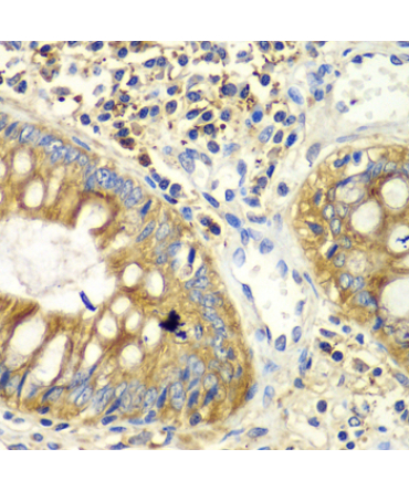 PICK1 Rabbit Polyclonal Antibody