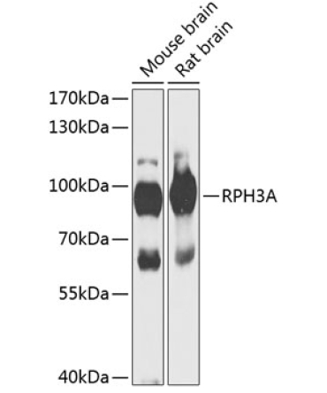 RPH3A Rabbit Polyclonal Antibody