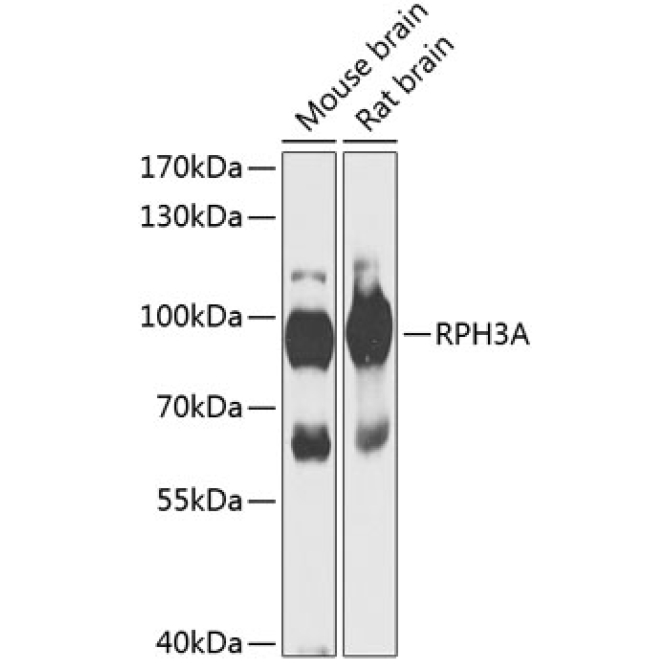 RPH3A Rabbit Polyclonal Antibody