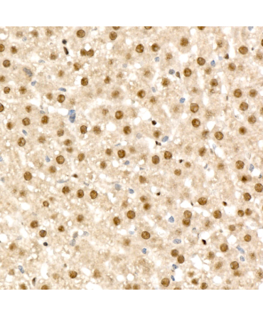 RAD54L2 Rabbit Polyclonal Antibody