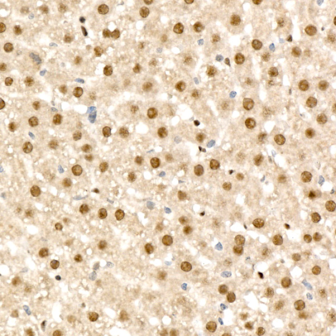 RAD54L2 Rabbit Polyclonal Antibody