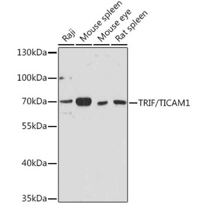 TRIF/TICAM1 Rabbit Polyclonal Antibody