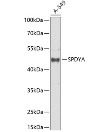 SPDYA Rabbit Polyclonal Antibody