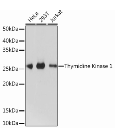 Thymidine Kinase 1 Rabbit Monoclonal Antibody