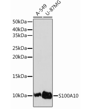 S100A10 Rabbit Monoclonal Antibody