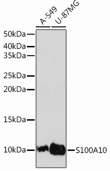 S100A10 Rabbit Monoclonal Antibody