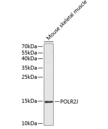 POLR2J Rabbit Polyclonal Antibody