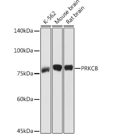PKC-beta Rabbit Polyclonal Antibody