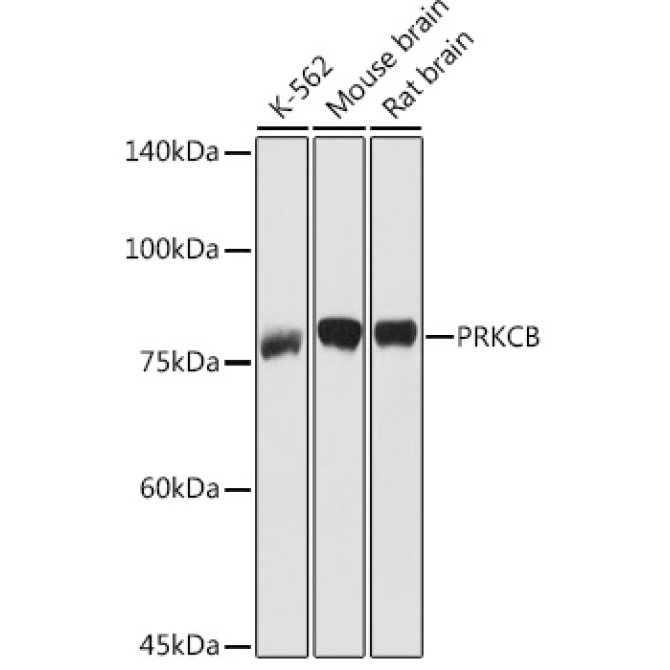 PKC-beta Rabbit Polyclonal Antibody