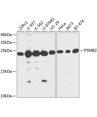 PSMB2 Rabbit Polyclonal Antibody