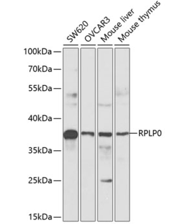 RPLP0 Rabbit Polyclonal Antibody