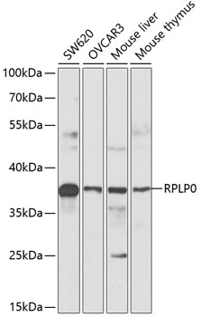 RPLP0 Rabbit Polyclonal Antibody