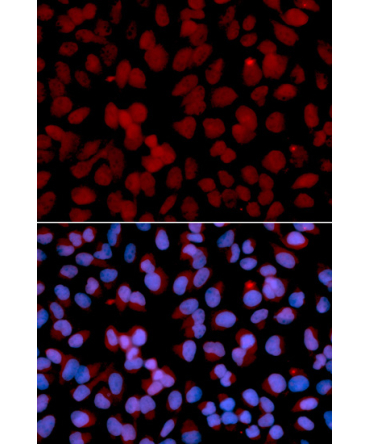 TNFAIP3 Rabbit Polyclonal Antibody