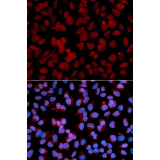 TNFAIP3 Rabbit Polyclonal Antibody