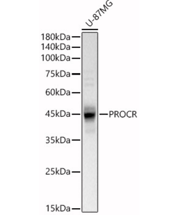 PROCR Rabbit Polyclonal Antibody