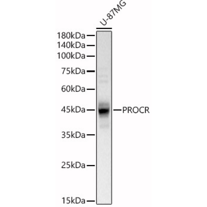 PROCR Rabbit Polyclonal Antibody