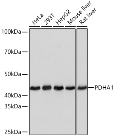 PDHA1 Rabbit Monoclonal Antibody