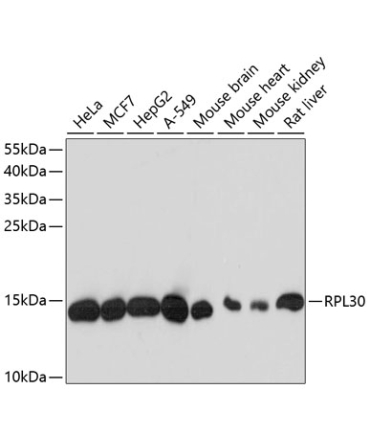 RPL30 Rabbit Polyclonal Antibody