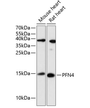 PFN4 Rabbit Polyclonal Antibody