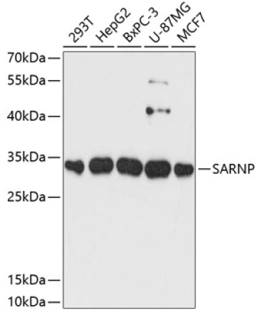 SARNP Rabbit Polyclonal Antibody