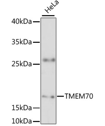 TMEM70 Rabbit Polyclonal Antibody