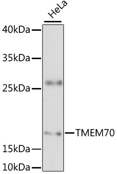 TMEM70 Rabbit Polyclonal Antibody
