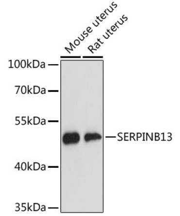 SERPINB13 Rabbit Polyclonal Antibody