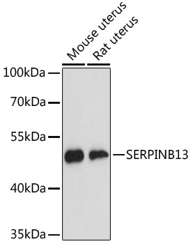 SERPINB13 Rabbit Polyclonal Antibody