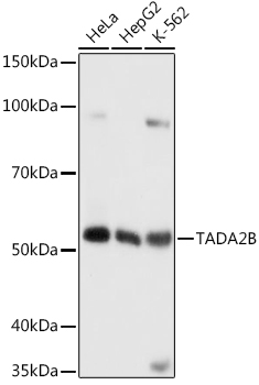 TADA2B Rabbit Polyclonal Antibody