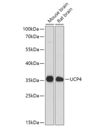 SLC25A27 Rabbit Polyclonal Antibody
