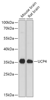 SLC25A27 Rabbit Polyclonal Antibody