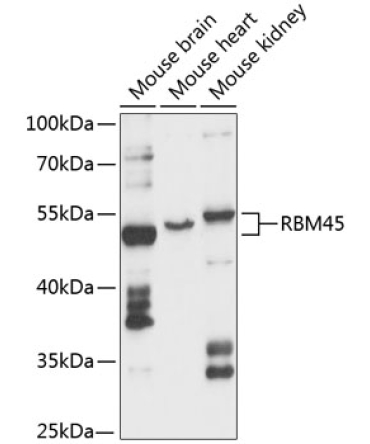 RBM45 Rabbit Polyclonal Antibody