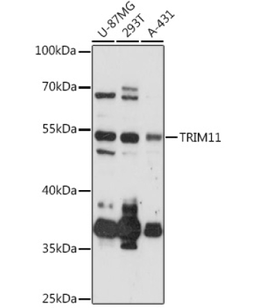 TRIM11 Rabbit Polyclonal Antibody