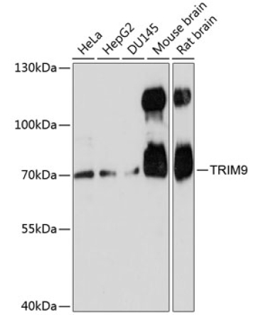 TRIM9 Rabbit Polyclonal Antibody