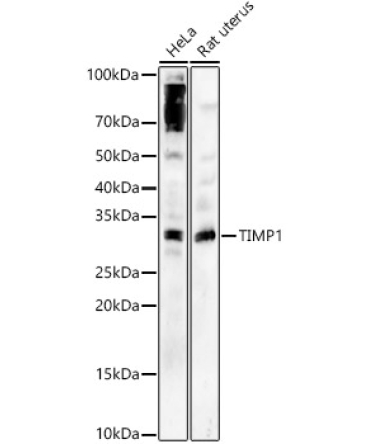 TIMP1 Rabbit Polyclonal Antibody