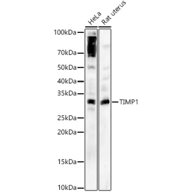 TIMP1 Rabbit Polyclonal Antibody