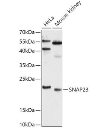 SNAP23 Rabbit Polyclonal Antibody