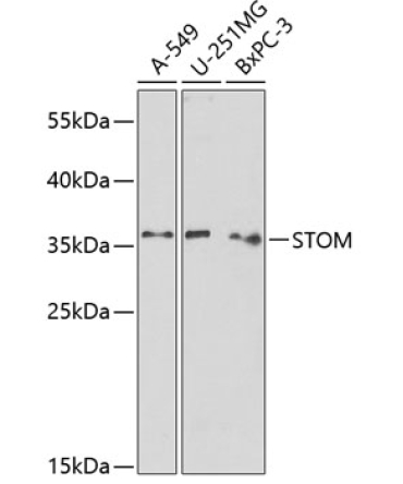 STOM Rabbit Polyclonal Antibody
