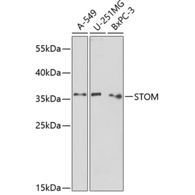 STOM Rabbit Polyclonal Antibody