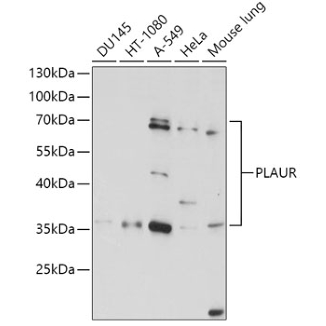 PLAUR Rabbit Polyclonal Antibody