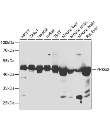 PHKG2 Rabbit Polyclonal Antibody