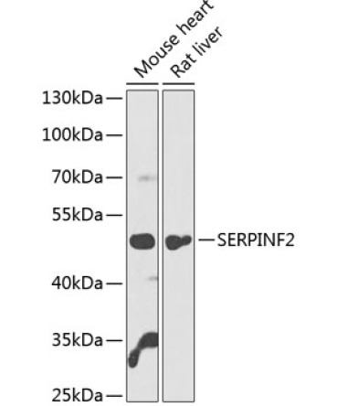 SERPINF2 Rabbit Polyclonal Antibody
