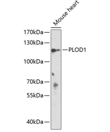 PLOD1 Rabbit Polyclonal Antibody