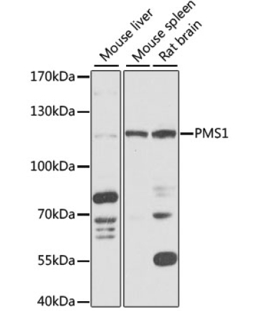 PMS1 Rabbit Polyclonal Antibody