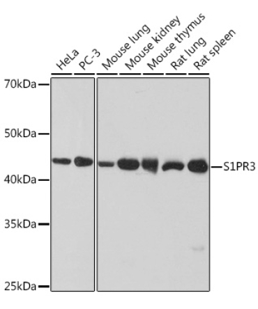 S1PR3 Rabbit Monoclonal Antibody