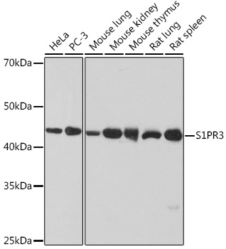 S1PR3 Rabbit Monoclonal Antibody