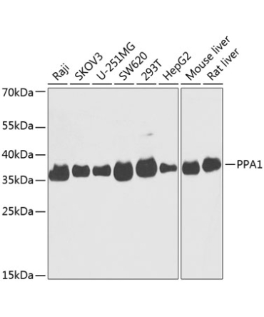 PPA1 Rabbit Polyclonal Antibody