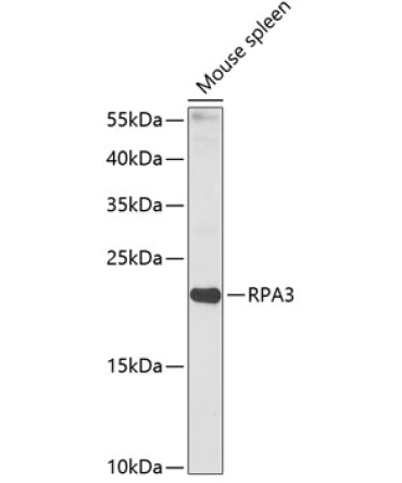 RPA3 Rabbit Polyclonal Antibody